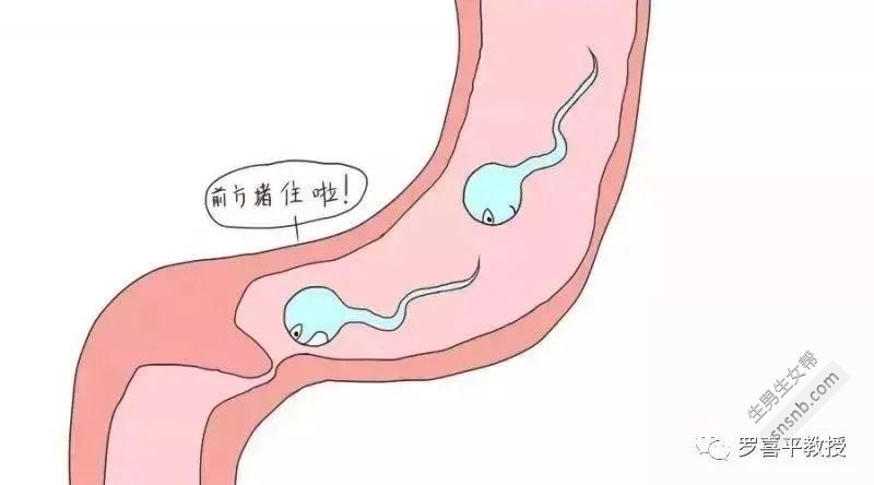 为什么输卵管会堵塞？输卵管堵塞的最佳方法和预防措施。(图1)