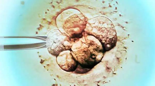 如果试管婴儿胚胎移植失败该怎么办