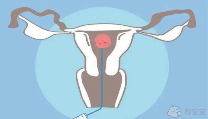 试管婴儿胚胎移植后躺着能预防宫外孕是真的吗？(图1)
